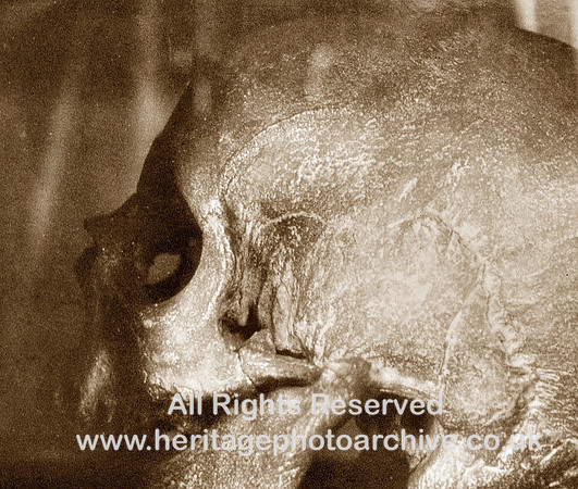 HRS 2106 Wardley Hall skull